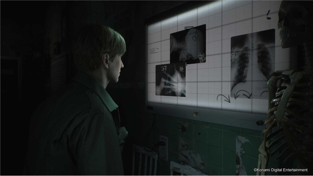 Silent Hill 2 Remake - PS5